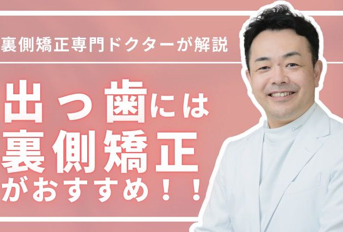 出っ歯に裏側矯正がオススメな理由とは？目立たず確実に治す