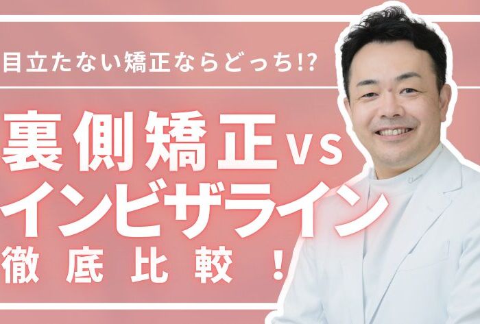 目立たない矯正対決！「裏側矯正」VS「インビザライン」徹底比較