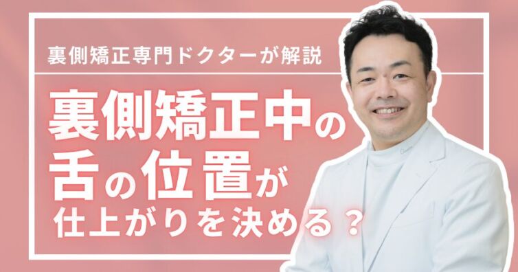 裏側矯正中の舌の位置が仕上がりの美しさを左右する理由