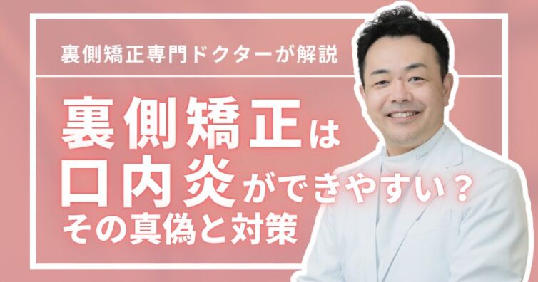 裏側矯正は口内炎ができやすい？その真偽と対策を専門医が解説