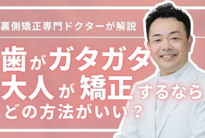 歯がガタガタな大人の矯正法は3つ！専門医がおすすめを徹底解説