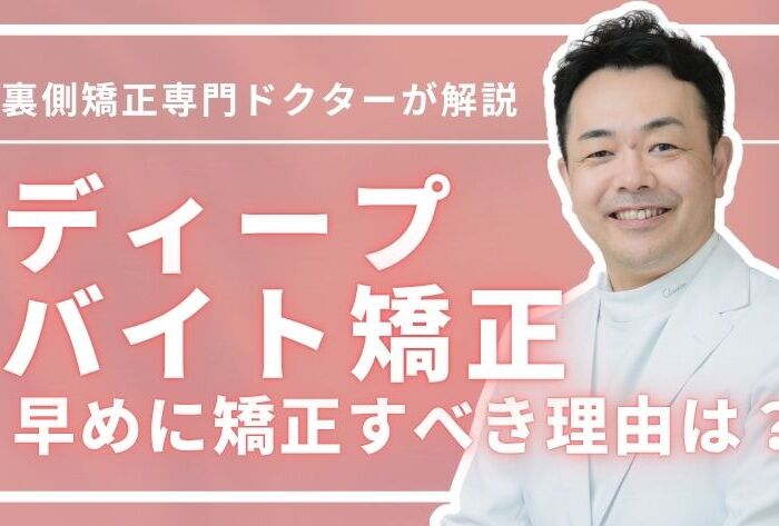 ディープバイト矯正での治し方！6つの原因＆早めに矯正すべき理由