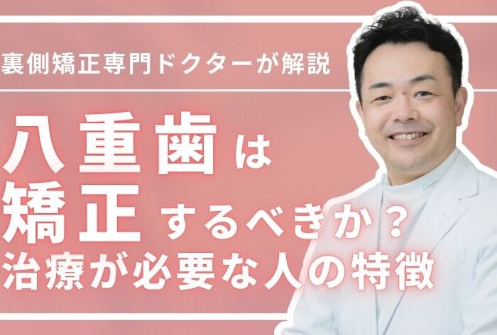 八重歯は矯正するべきか？治療が必要な人の特徴※セルフチェックあり