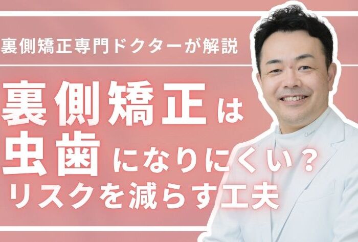 裏側矯正は虫歯になりにくい？虫歯リスクを減らす5つの工夫も解説
