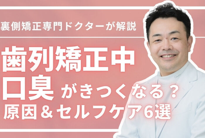 歯列矯正中は口臭がきつくなる？4つの原因＆セルフケア6選