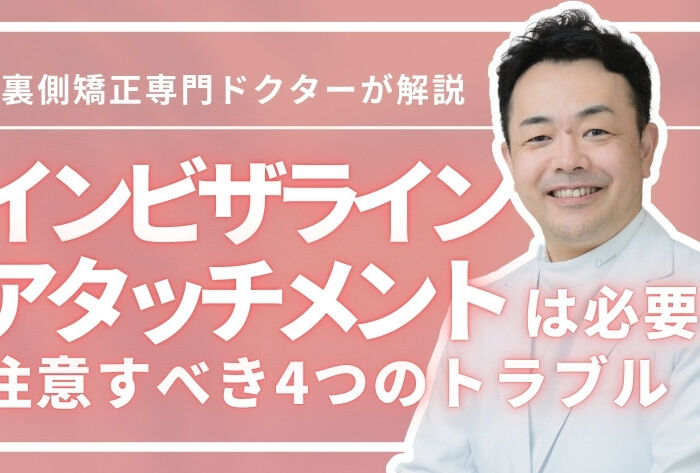 インビザラインのアタッチメントは必要？注意すべき4つのトラブル