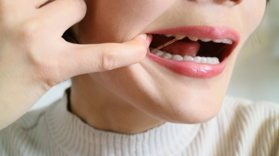 インビザラインのゴムかけ