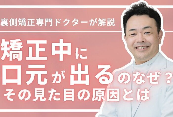 矯正中に口元が出るのはなぜ？見た目の原因・表側＆裏側矯正の違い