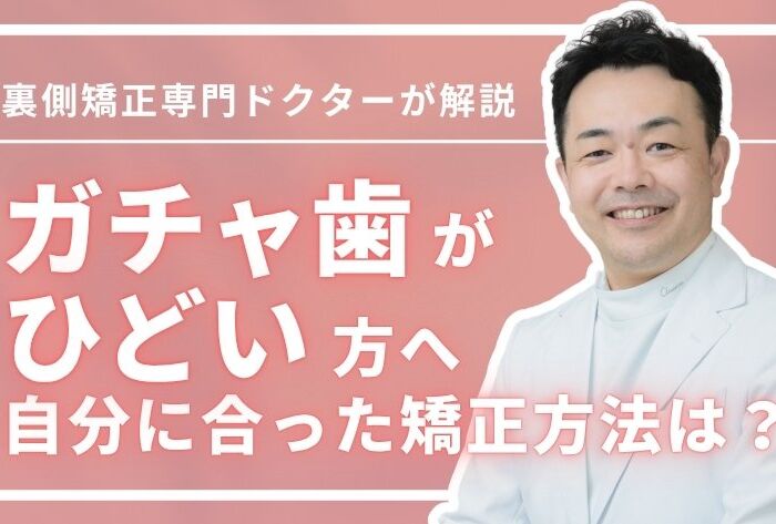 ガチャ歯がひどい方へ｜原因から自分に合った矯正方法まで全部わかる