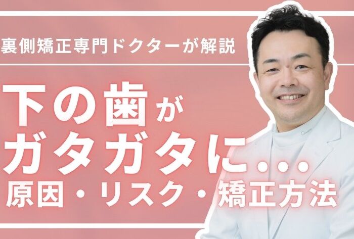 下の歯がガタガタになってきた…なぜ？原因・リスク・矯正方法を徹底解説